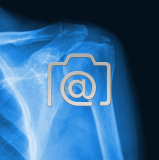 7.06_schulter.tendinitis.calcarea-0001