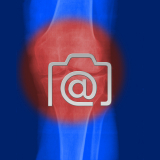 6.02_knie.gonarthrose-0001.ap-s