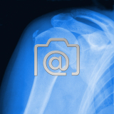 7.04_schulter.tendinitis.calcarea-0001.ap