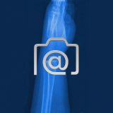 4.04_hand.radiusgruenholzbruch.kind-0001.lat