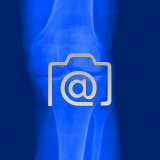 6.01_knie.gonarthrose-0001.ap