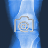 6.03_knie.normal-0001.ap