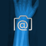 4.03_hand.radiusgruenholzbruch.kind-0001.ap