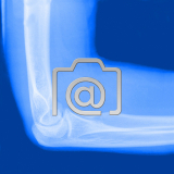 1.01_ellbogen.epicondylitis-0001.lat