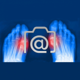 2.03_fuesse.zehen.arthrose.hallux.rigidus-0001.ap-s